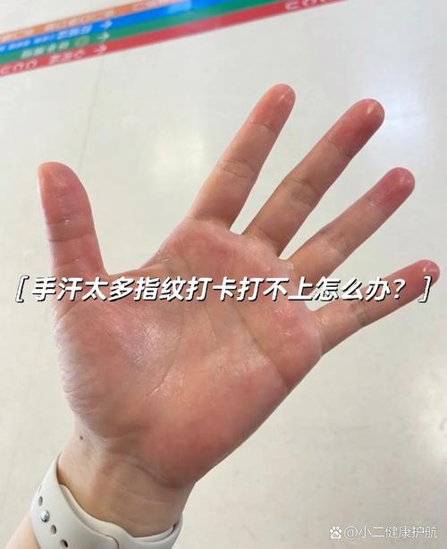 手纹脸纹打卡都打不上怎么回事