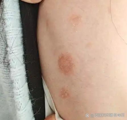 红点放大多少倍