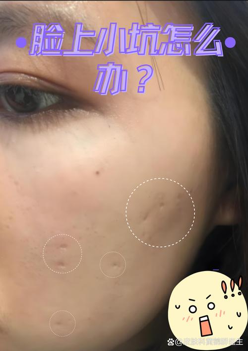 膜上有小坑会伤屏幕吗