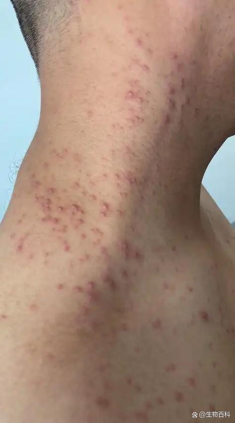 小猫身上有病菌吗会传染吗