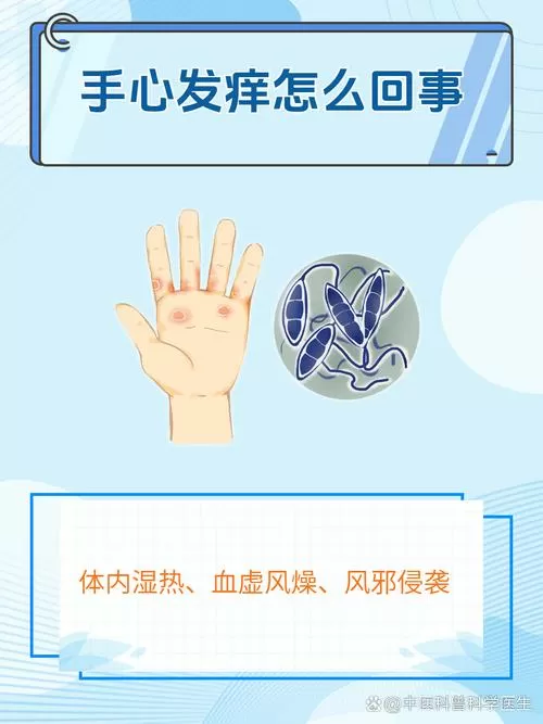 睡觉挠手心是什么原因
