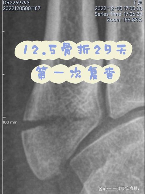 移植第二十九天有暗区