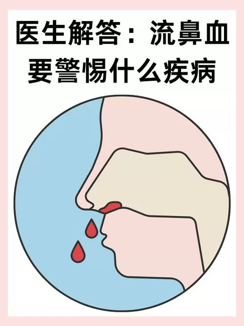 打喷嚏流鼻血正常吗