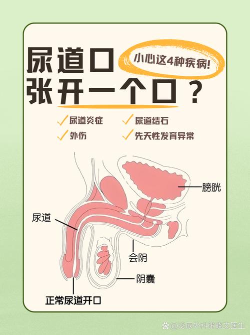 100款禁用黄免费a尿道口缩略图
