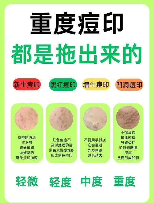 豆坑痘印还能去掉吗图片