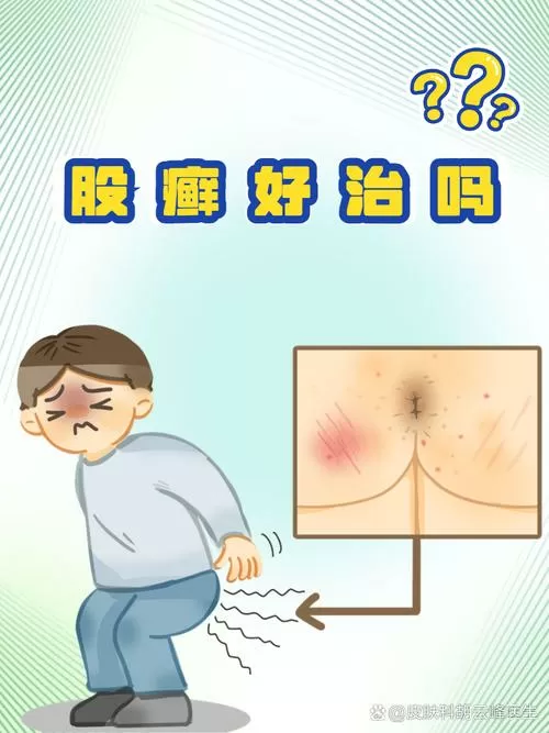 屁股痒的解决方法图标