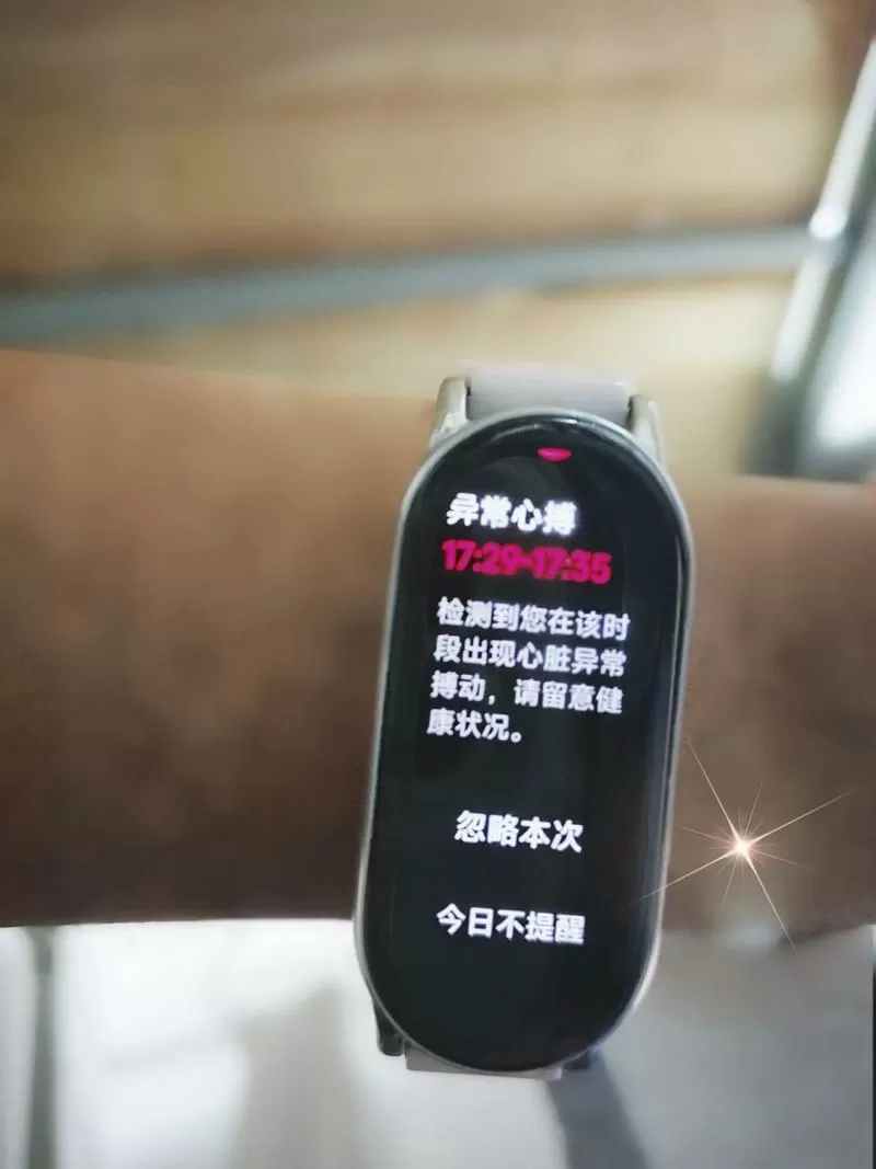 小米手环消息提醒老是延迟