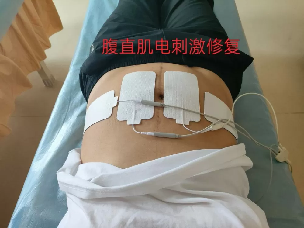 腹直肌电疗10次能修复吗
